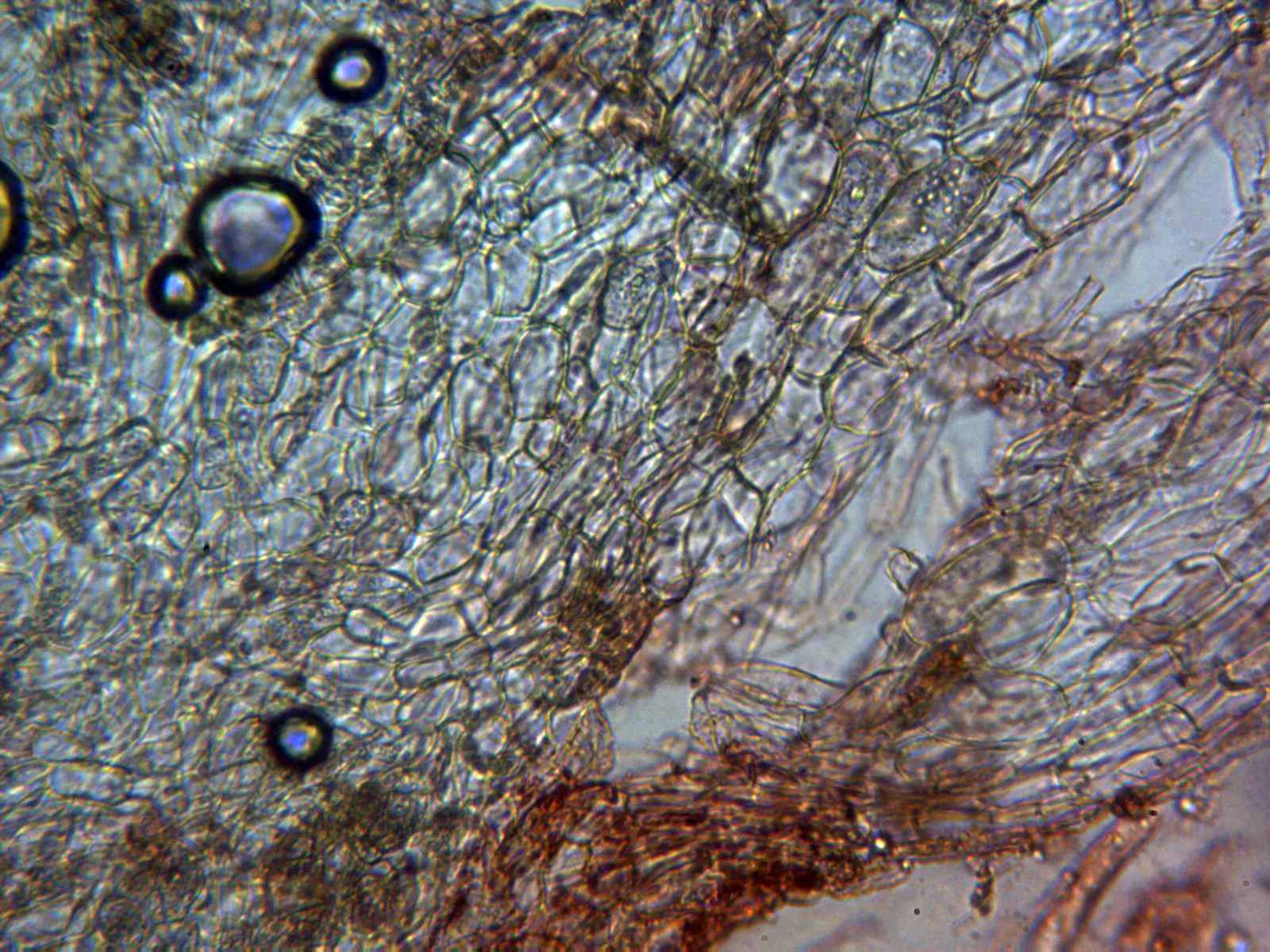 14 - Excípulo ectal 2 x 400